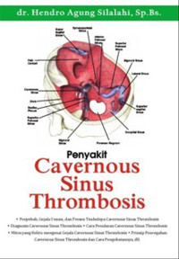 Penyakit Cavernous Sinus Thrombosis